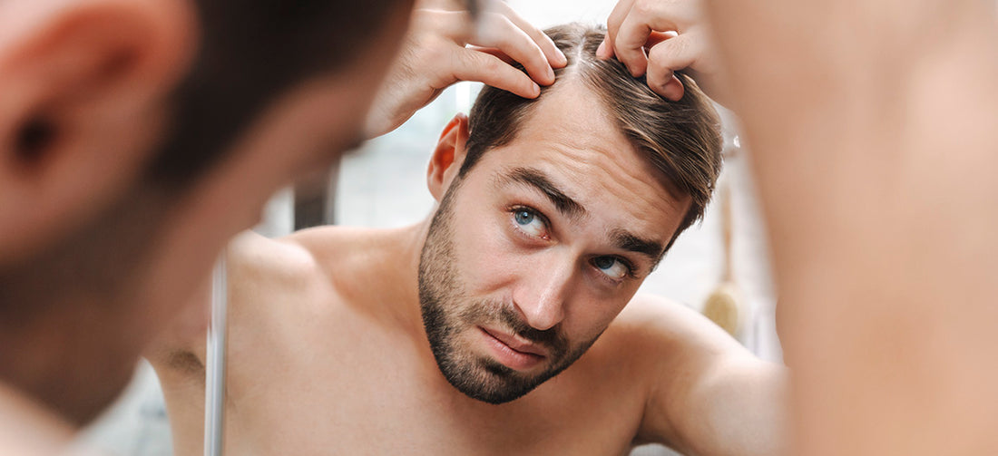 ¿Se te está cayendo el cabello? Aquí tienes unos consejos